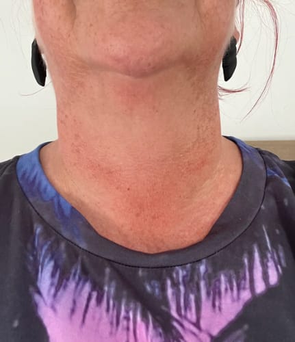 Customer photo review of Collagen + Hemp Neck Firming Serum