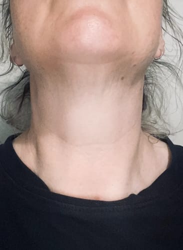 Customer photo review of Ageless Wonder