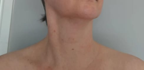 Customer photo review of Collagen + Hemp Neck Firming Serum