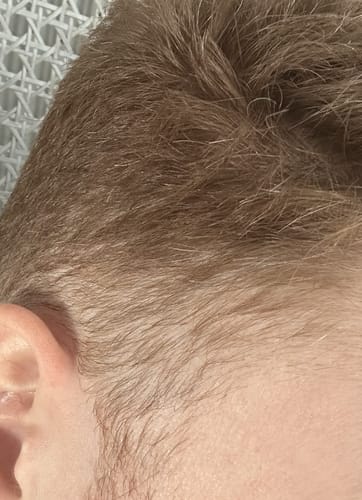 Customer photo review of Seb Natural Calming Serum