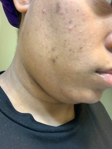 Monitre O. review of Turmeric Brightening Soap (with Vitamin C, Alpha Arbutin, Oat) image 1 out of 2