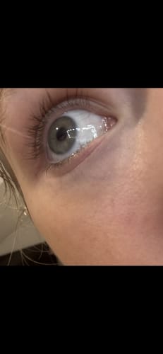 Customer photo review of Lash Growth Serum