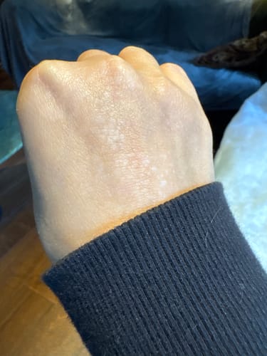 Customer photo review of Calm Balm