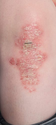 Customer photo review of Grass-Fed Tallow Body Balm | Cold Weather Protection