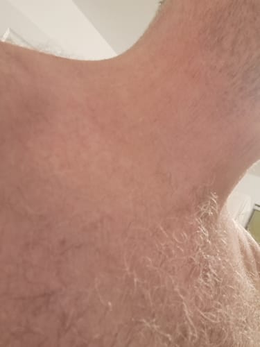 Customer photo review of Seb Natural Soothing Balm
