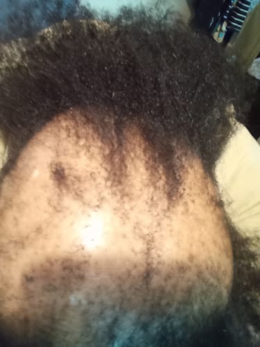 Customer photo review of Rennora Hair Growth Spray