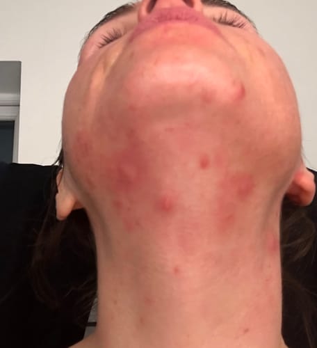 Customer photo review of Radiance Powder