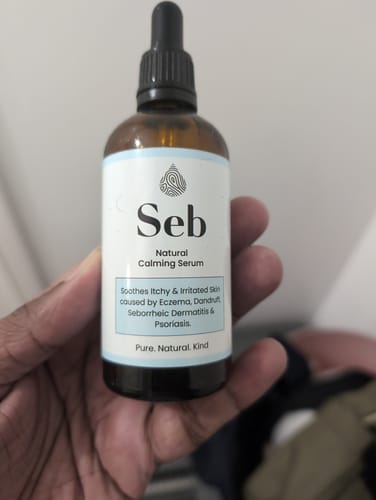 Customer photo review of Seb Natural Calming Serum