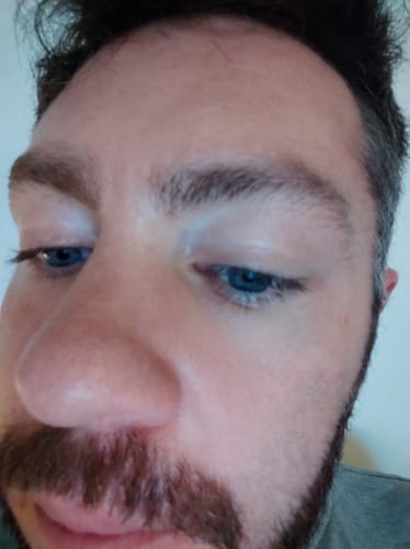Customer photo review of Seb Natural Calming Serum