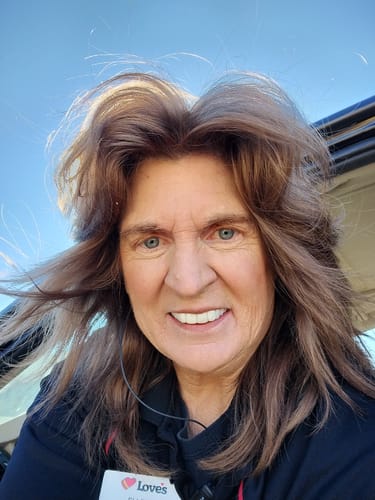 Customer photo review of Pop On Veneers - Custom Made Production