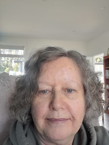 Customer photo review of SEA BUCKTHORN SERUM - 30ml