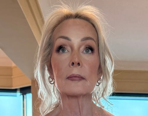 Customer photo review of The Micro Infusion System™