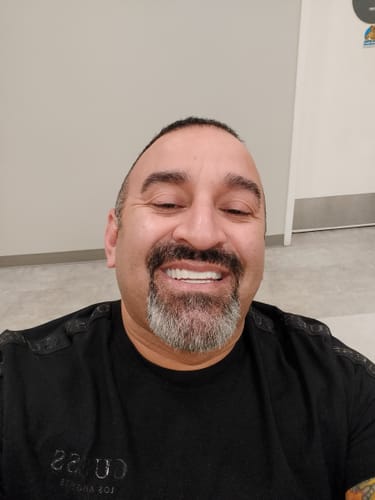 Customer photo review of Spare Veneers