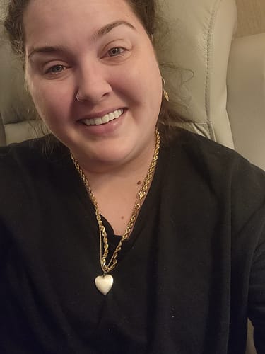 Customer photo review of Pop On Veneers - Custom Made Production