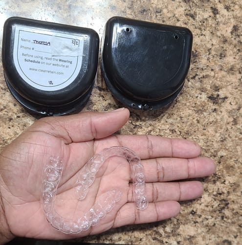 Customer photo review of Upper and Lower Retainers Set