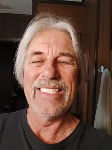 Customer photo review of REMAKE - Loss Protection Veneers - Bottom Only