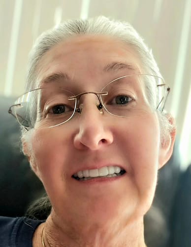 Customer photo review of Pop On Veneers - Custom Made Production