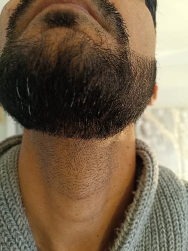Customer photo review of Seb Natural Calming Serum