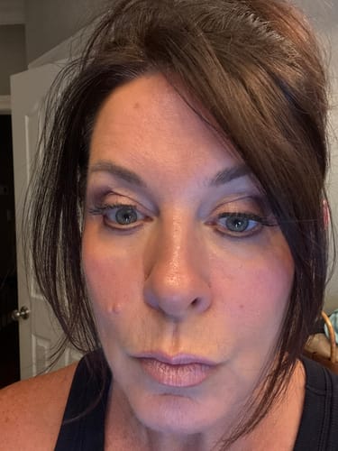 Customer photo review of The Micro Infusion System™