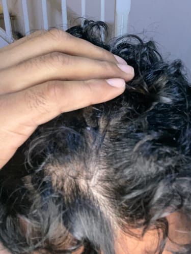 Customer photo review of Seb Natural Calming Serum