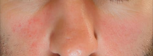 Customer photo review of Seb Natural Calming Serum