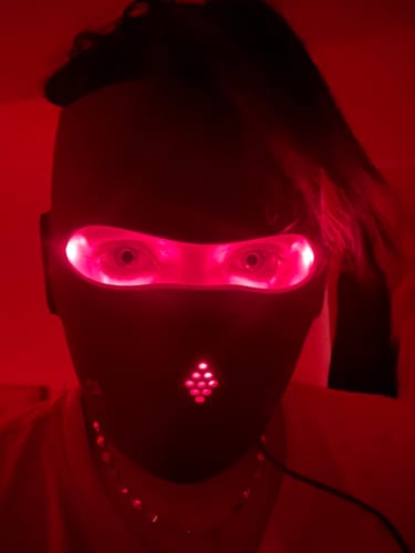 Customer photo review of JOVS 4D Laser Light Therapy Mask