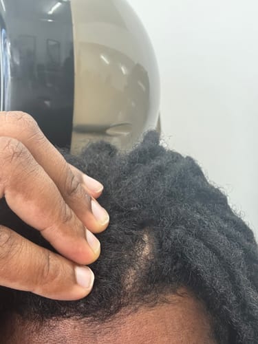Customer photo review of Seb Natural Calming Serum