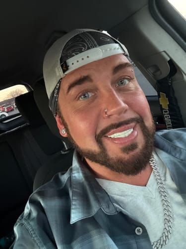 Customer photo review of Pop On Veneers - Custom Made Production