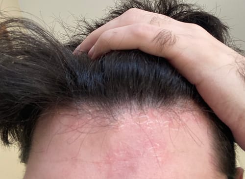 Customer photo review of Seb Natural Calming Serum