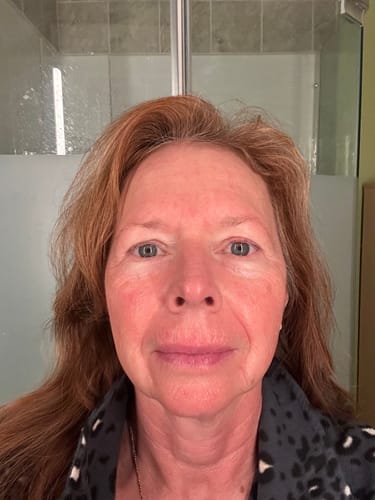 Customer photo review of FREE Shipping Protection