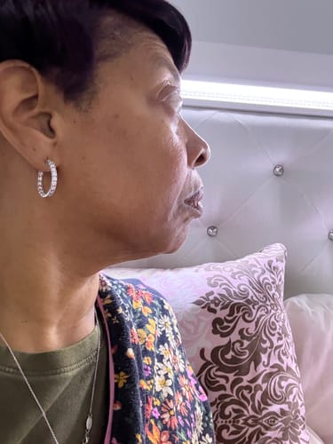 Customer photo review of The Micro Infusion System™