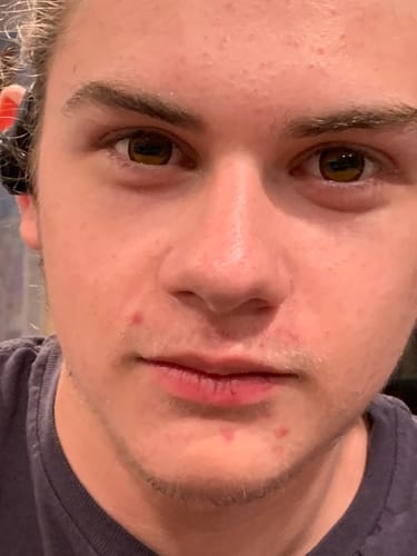 Customer photo review of Goat Eye Contacts