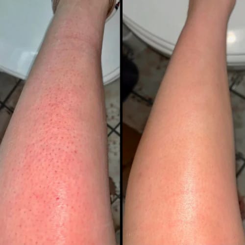 Customer photo review of LumiBare™ — Crema Depiladora Total