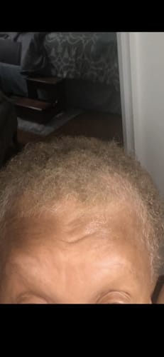 Customer photo review of Rennora Hair Growth Serum