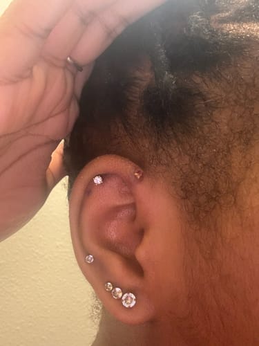 Customer photo review of Piercing Bump & Keloid Treatment Oil Wholesale (Custom)