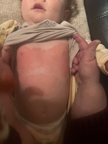 Customer photo review of Grass-Fed Whipped Body Tallow | Moisturising Cream