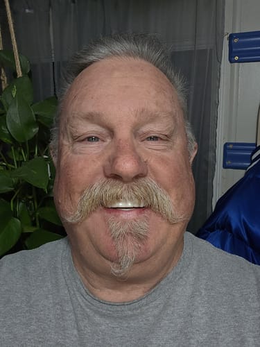 Customer photo review of Pop On Veneers - Custom Made Production