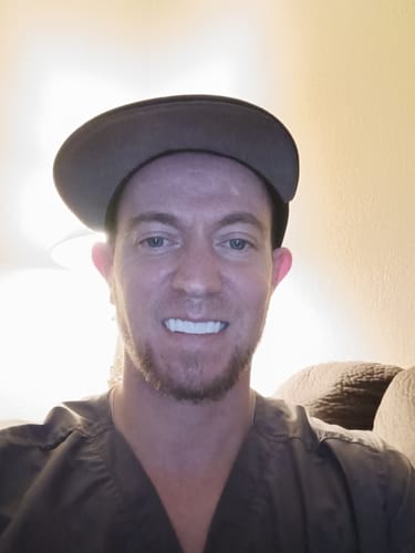 Customer photo review of Pop On Veneers - Custom Made Production