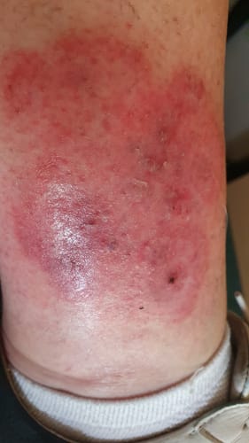 Customer photo review of Calm Balm