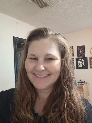 Customer photo review of Pop On Veneers - Custom Made Production