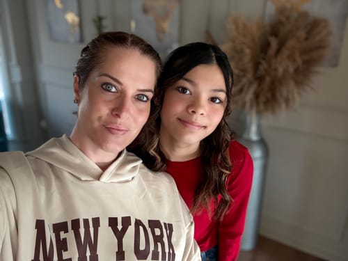 Customer photo review of Grass Fed Tallow & Honey Balm