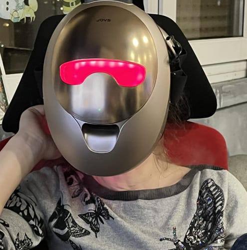 Customer photo review of JOVS 4D Laser MAX-Mist Mask Device (Limited Edition)