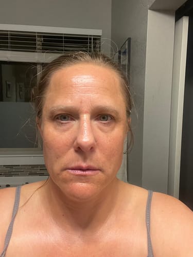 Customer photo review of Grass Fed Tallow & Honey Balm