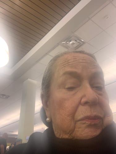 Customer photo review of Grass Fed Tallow & Honey Balm