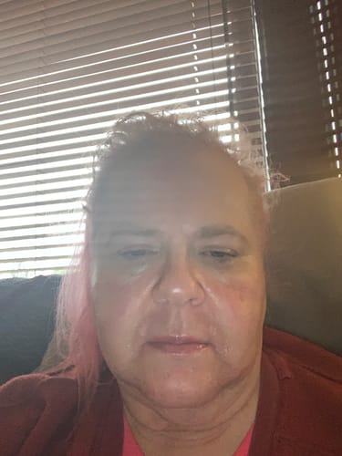 Customer photo review of Grass Fed Tallow & Honey Balm