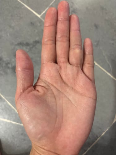 Customer photo review of Jolicare Cream