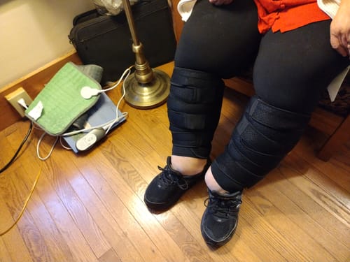 Customer photo review of The Compression System For The Feet & Calves (2 pack Each) | BLACK