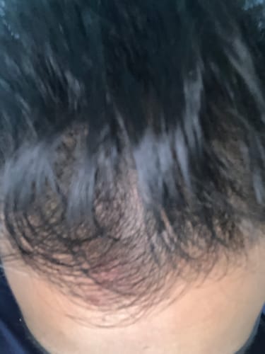 Customer photo review of Seb Natural Calming Serum