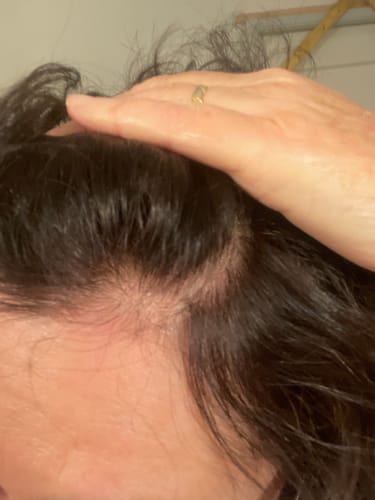 Customer photo review of Cell Happy Co - Toner anti-chute de cheveux - 120ml