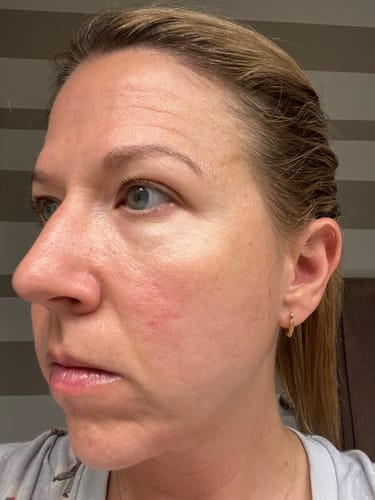 Customer photo review of Grass Fed Tallow & Honey Balm